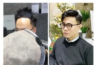 发际线假发选择靓首假发补发(北京国贸店)口碑好不用做广告