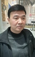 北京遗传性脱发假发