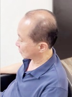 北京高档假发男士
