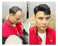 北京秃头假发