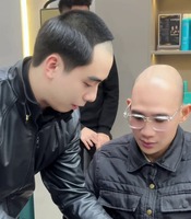 北京男士头顶补发