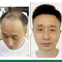 北京瑞士网假发