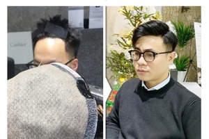 发际线假发选择靓首假发补发(北京国贸店)口碑好不用做广告